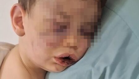 Denizli’de 2 yaşındaki bebek, annesinin sevgilisi tarafından öldüresiye dövüldü! Bakanlık harekete geçti